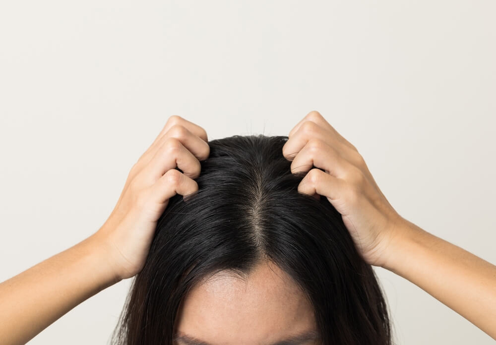 woman scalp