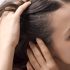 woman scalp care