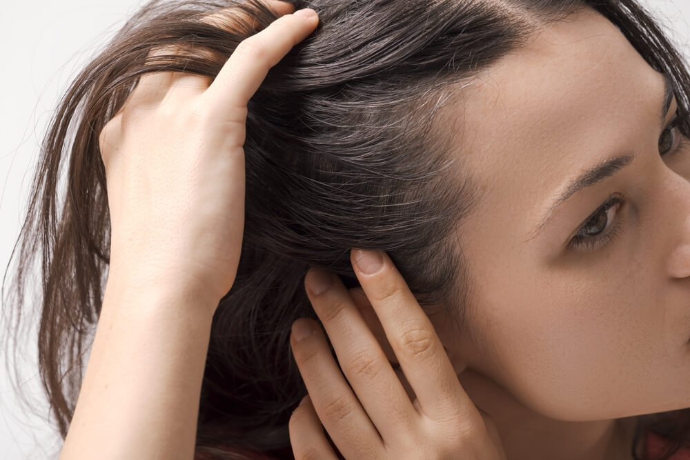 woman scalp care