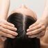 woman scalp